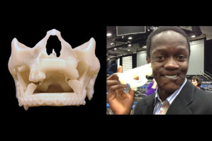 3D печать восстановит лицо молодого человека